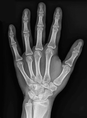A hand X-ray scan